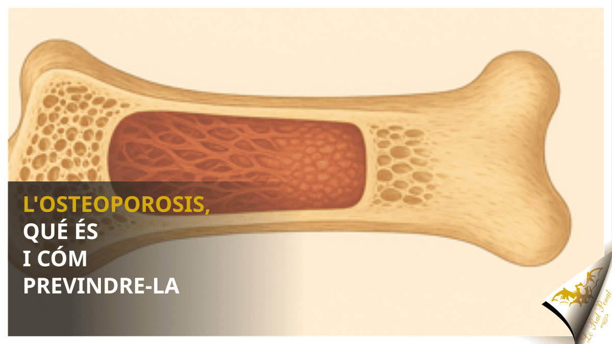 L’osteoporosis, qué és i cóm previndre-la