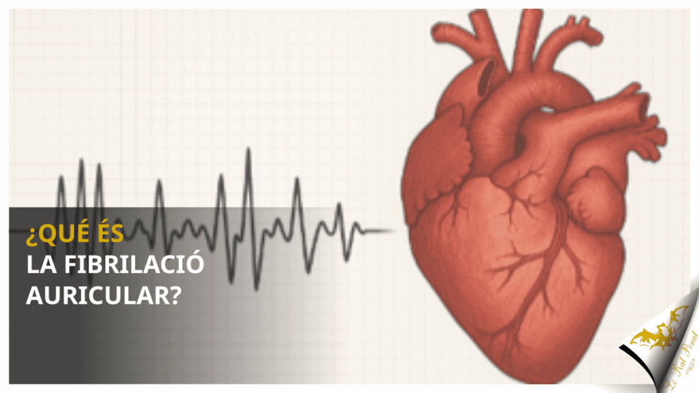 ¿Qué és la fibrilació auricular?