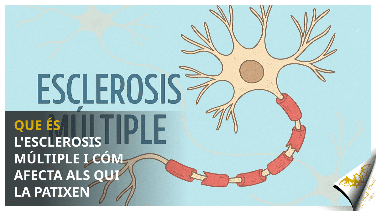 Qué és l’esclerosis múltiple i cóm afecta als que la patixen