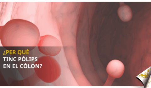 ¿Per qué tinc pòlips en el còlon?