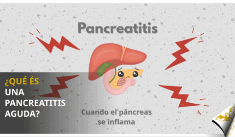 ¿Qué és una pancreatitis aguda?